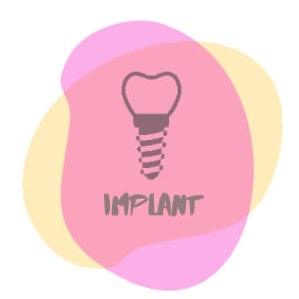 Implant